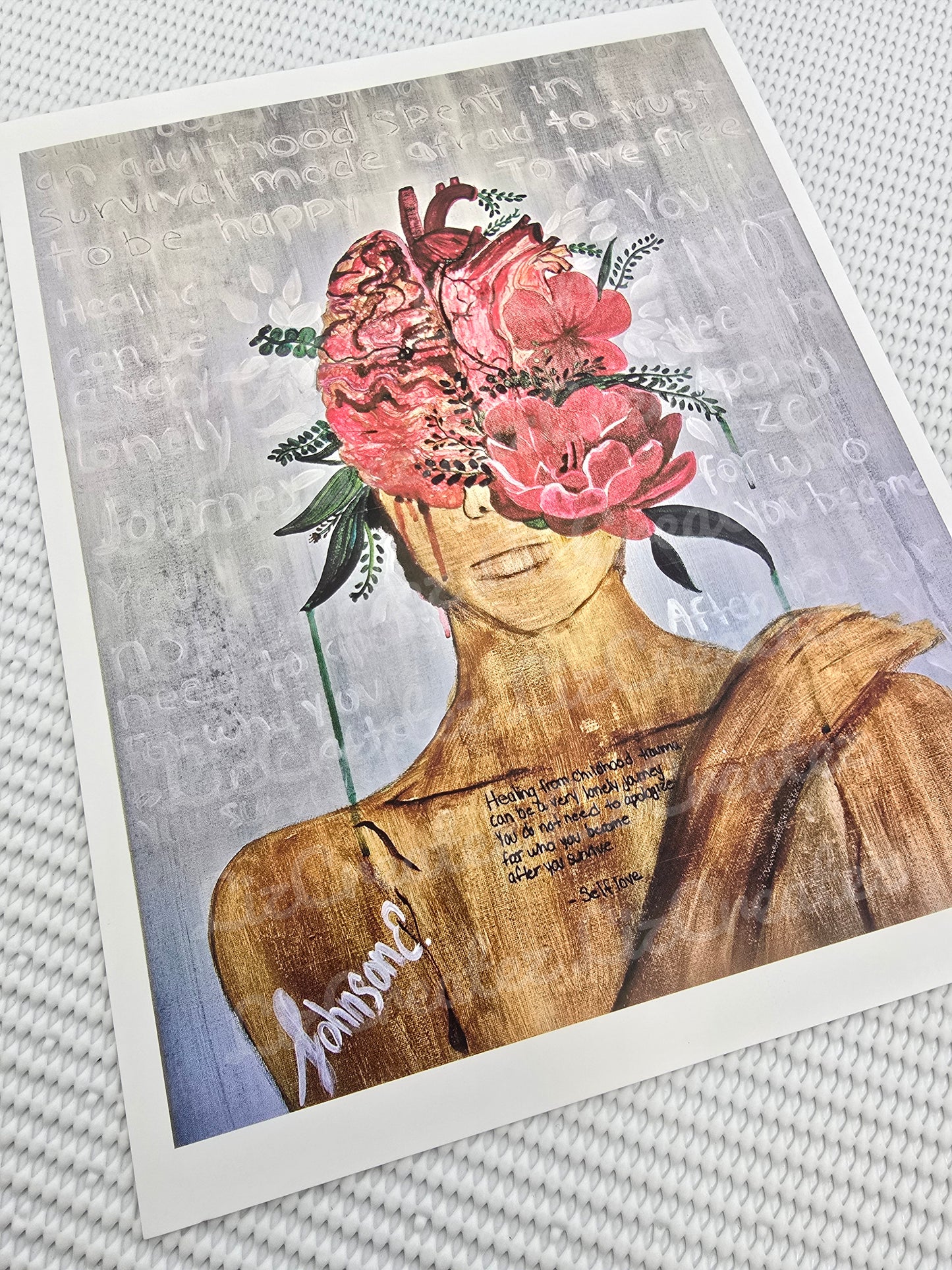 Surviving - Fine Art Print