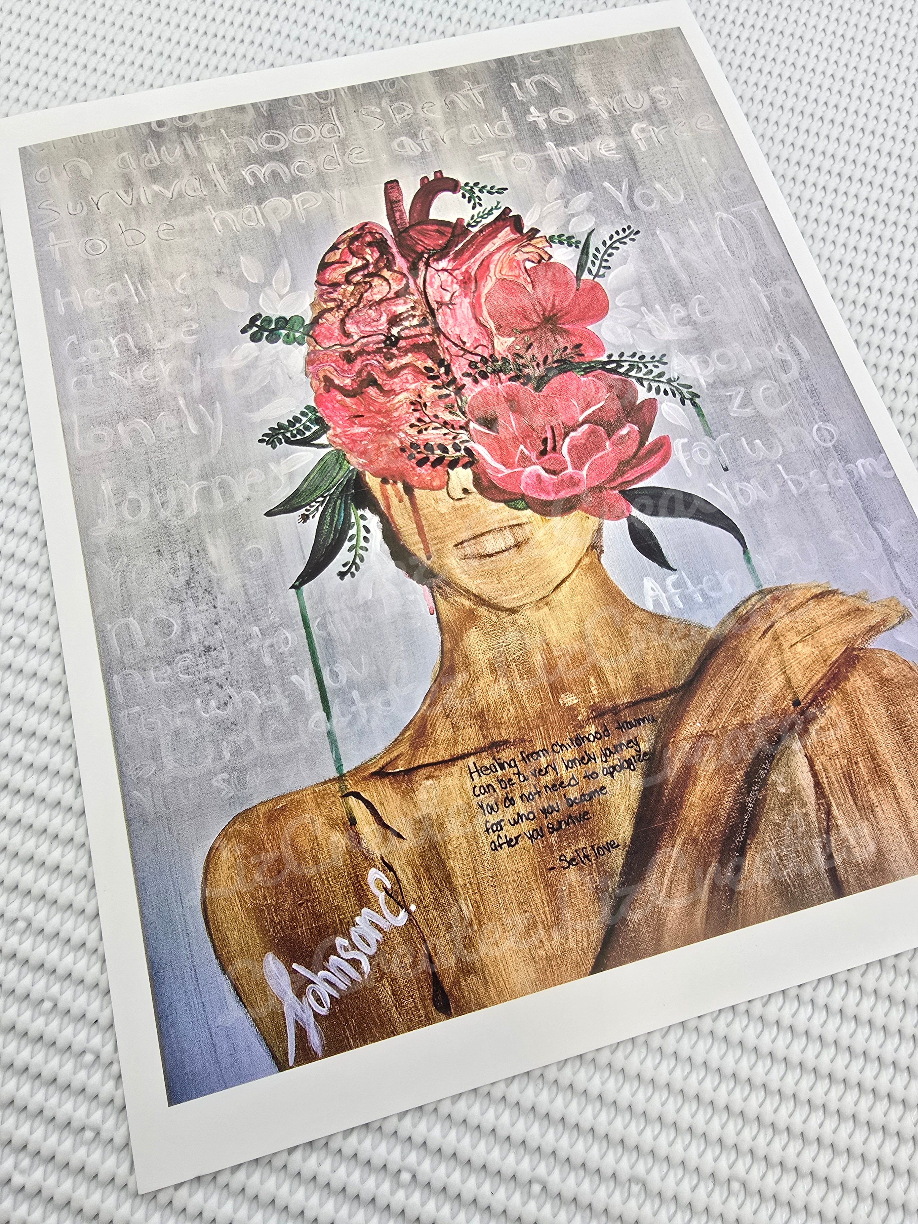 Surviving - Fine Art Print